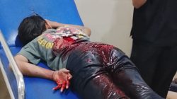 Geng Motor Serang Warga di Abubakar Lambogo Makassar, Bocah 13 Tahun Kena Tebas di Punggung